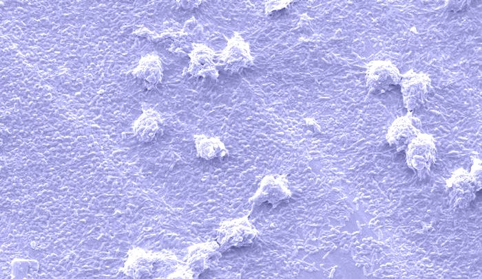 A Better Way to Understanding Your Microbial Jungle: What&rsquo;s In There and How to Know When It&rsquo;s Gone